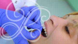 Dental veneers make a big difference.