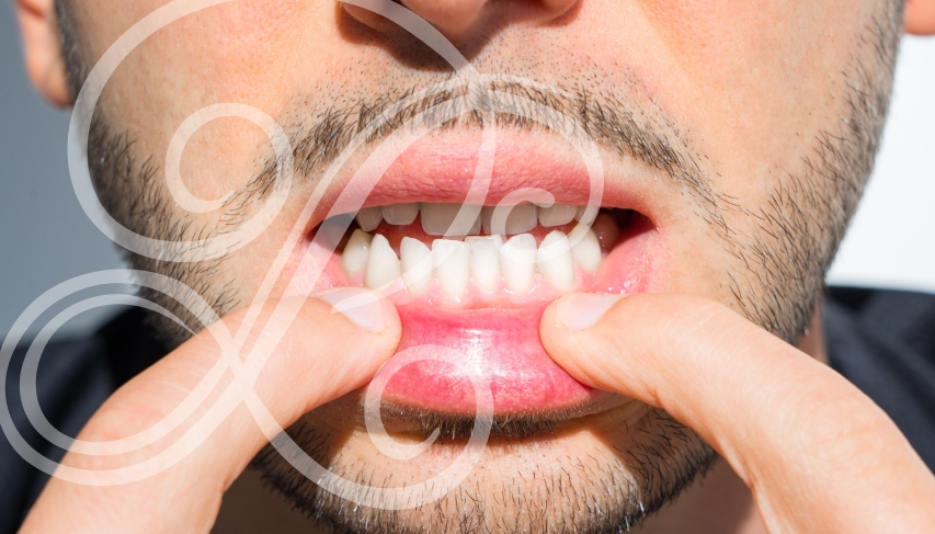 You don't have to live with crooked teeth.