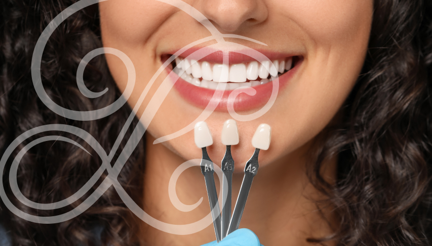 Modern dental veneers transform your smile.